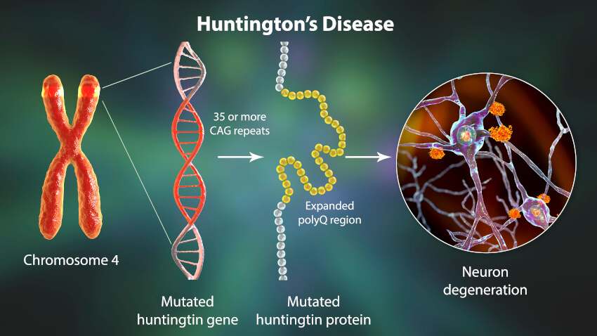 Huntington's disease