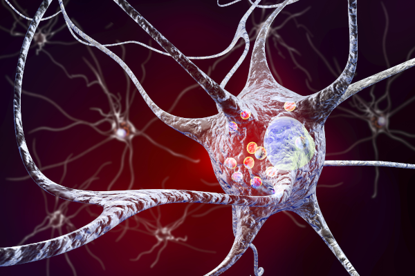 neuron and lewy bodies